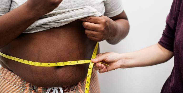 Pesquisadores propõem nova forma de diagnosticar obesidade – 06/07/2024 – Equilíbrio e Saúde