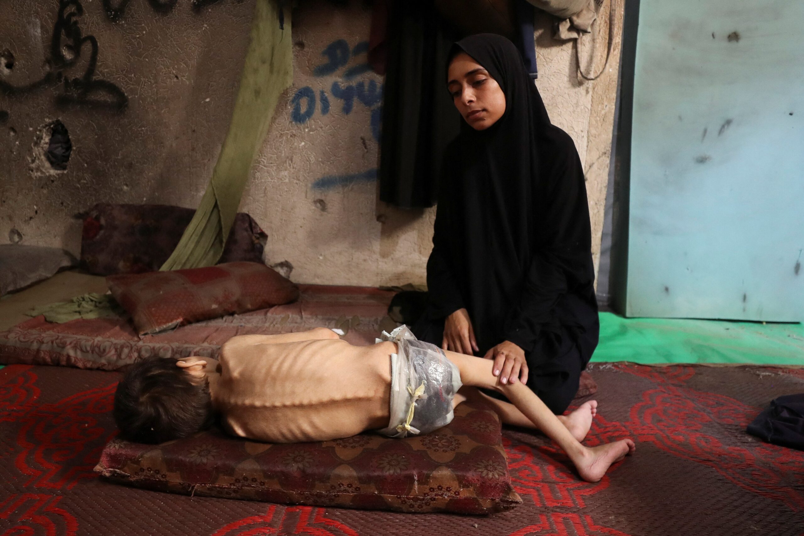 Falta de alimento, desnutrição, e mortalidade: qual o estágio da fome em Gaza
